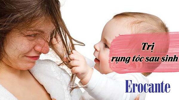 Cách trị rụng tóc sau sinh