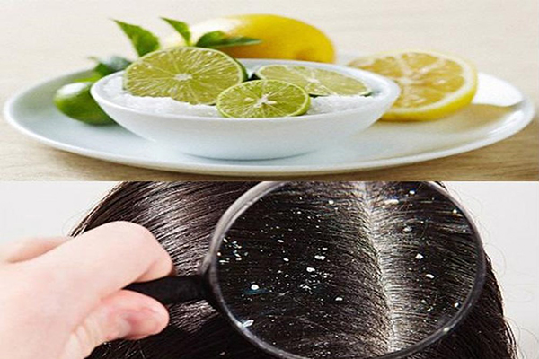 Axit citric trong chanh có tác dụng loại bỏ dầu thừa trên tóc và da đầu nhanh chóng