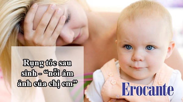 rụng tóc sau sinh