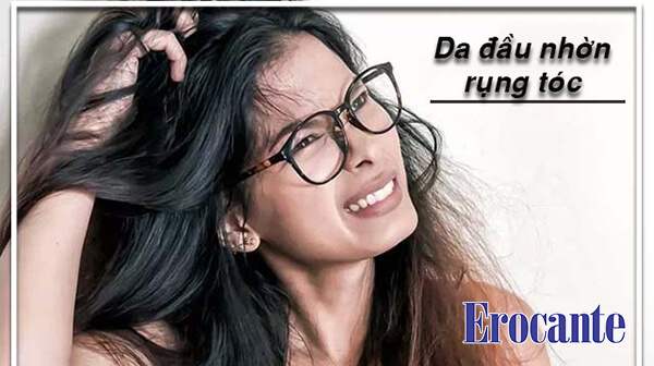 Tóc dầu và rụng nhiều