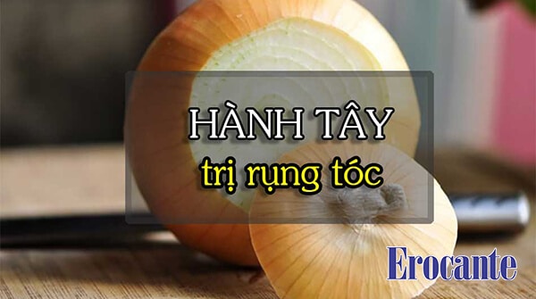Cách trị rụng tóc với hành tây