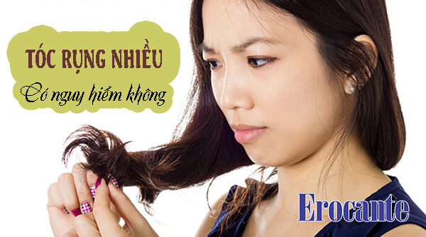 Tóc rụng nhiều có nguy hiểm không