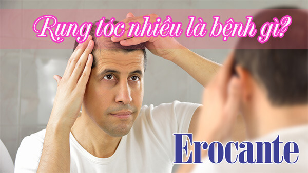 Tóc rụng nhiều là bệnh gì