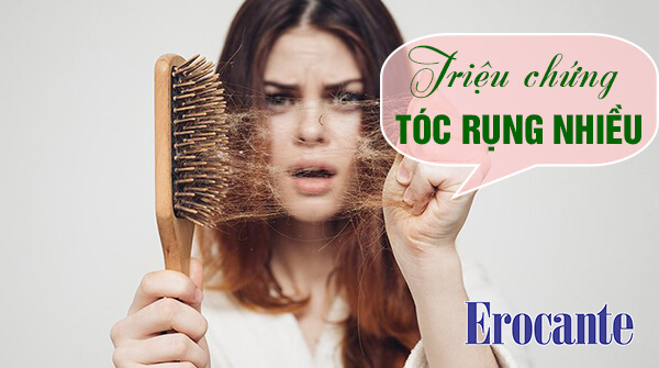 Triệu chứng tóc rụng nhiều