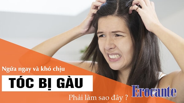 Cách điều trị tóc gàu